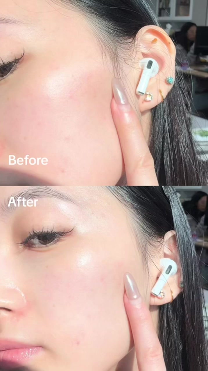 🔹 نومبوزين تونر رقم 3 – إشراقة فائقة بلمسة واحدة!🔹  

✨ السر وراء بشرة متوهجة وناعمة يبدأ هنا! ✨  
نومبوزين تونر رقم 3 هو خطوة أساسية لكل من يسعى للحصول على بشرة صحية ومشرقة. بتركيبته المتقدمة، يعمل على تحسين ملمس البشرة وتوحيد لونها، ليمنحك إشراقة طبيعية لا تقاوم!  

🔸 
✔️ ترطيب عميق يدوم طوال اليوم دون الشعور باللزوجة.  
✔️ يعزز امتصاص البشرة للمكونات الفعالة، مما يجعل منتجات العناية أكثر فاعلية.  
✔️ يساهم في تهدئة البشرة وتوحيد لونها، ليمنحك ملمسًا ناعماً وإشراقة متوهجة.  
🌟🌟🌟🌟🌟🌟🌟🌟
للحجز لا تترددوا بمراسلتنا."😍💜
التوصيل بغداد والمحافظات💜🚕🚕

"جربها مرّة، وبتصير من اختياراتك الدائمة 💯
نقدّم لك الأفضل.. لأنك تستحق الجودة بدون مجازفة ✅"

#نومبوزين #تونر_رقم3 #بشرة_مشرقة #عناية_بالبشرة #جمال_دائم #منتجات_تجميل  

💎 خطوة بسيطة نحو إشراقة دائمة – لأن جمالك يستحق الأفضل!


**إذا كنت صاحب هذا الإعلان وتريد حذفه لأي سبب، رجاءا أرسل رسالة إلى الدعم الفني**