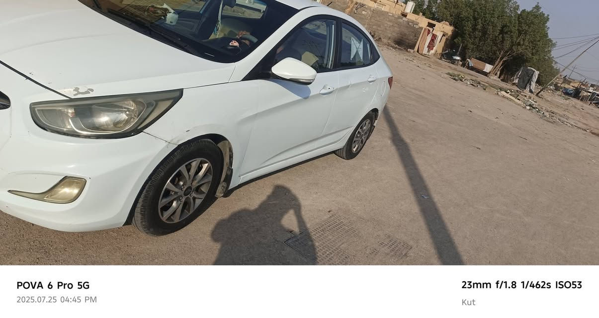 سلام عليكم اكسنت 2016 ماشيه 100خليجي للبيع رقم بصره بسمي تحويل ثاني يوم كير مكينه خير من الله مكينه ابدل بيه كاز كيت بيه3قطع باب السايق والباب الخلفي وقبق جنطه رش بدون معجون مكان واسط كوت مركز المدينه السعر 95وبيه مجال حك الجيه استفسار اكثر ***********
