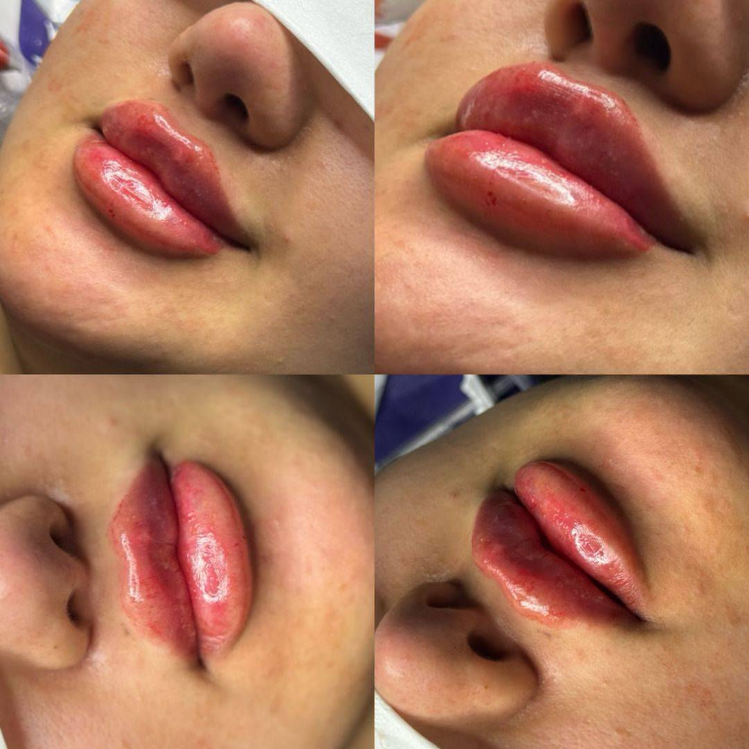 عروض عيد الحب 🫀❤️
حنين العزاوي – Haneen Alazzawy ✨
دقة، ذوق، ونتيجة تفتح النفس ❤️
📍 المكان: بغداد – الحسينية❤️
مقابل كراج الأسدي❤️
عيادة خبراء الطب التخصصي❤️
📞 رقم الهاتف: ***********
