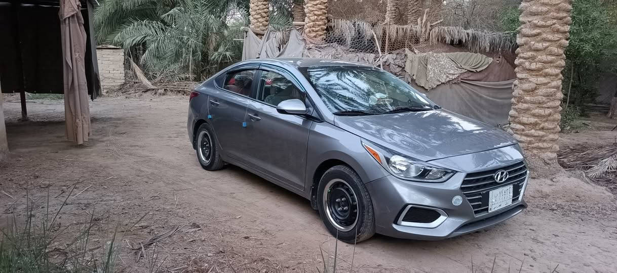 السلام عليكم
هيواندي اكسنت لون سلفر 2022 للبيع رقم بابل الماني سنوية لل ٢٩  مكينة 1600cc شاشة وكاميرا وتحكم ستيرن ماشية 22 الف ميل حادث جاملغ وبنيد بدون دواخل السيارة جديدة وماشية قليل استخدام قليل السعر 125 قابل للتفاوص

للتواصل ***********
