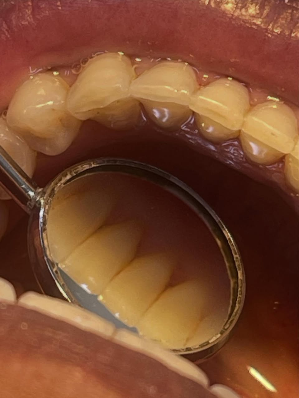 قلع وتعويضات متحركة وتنظيف اسنان تحت اشراف اطباء اختصاص 
مستشفى طب الاسنان التعليمي جامعة بغداد قرب مصرف الرافدين📍
للتواصل ***********
