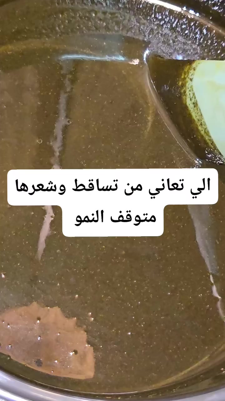 الي تعاني من تساقط بكثرة 
وشعرها متوقف النمو 
وعدها قشره وحكه


**إذا كنت صاحب هذا الإعلان وتريد حذفه لأي سبب، رجاءا أرسل رسالة إلى الدعم الفني**