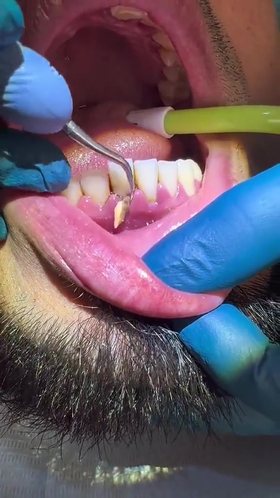 عياده النور لطب الأسنان وتجميل


**إذا كنت صاحب هذا الإعلان وتريد حذفه لأي سبب، رجاءا أرسل رسالة إلى الدعم الفني**