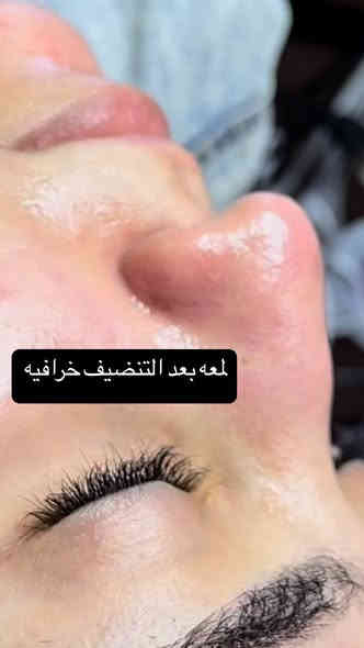 شاركو منشور بنات خل بنات تستفاد

مشاركه. شغلنا بل كروبات هاي شروط مسابقه 
ابداعنه مستمر

عنوان غربي ثاني شارع كراج المشتل شارع حجي سليمان ***********

صالون نيولوك متواجدين يوميا من9 صباحًا الى ٧ مساءًا
صبغ، قص، تسريح، اضافر، بديكير،رموش،، حواجب،مكياج،عروسات... ميش ' حفافه

