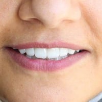 ابتسامة هوليوود • عيادة أسنان • الناصرية