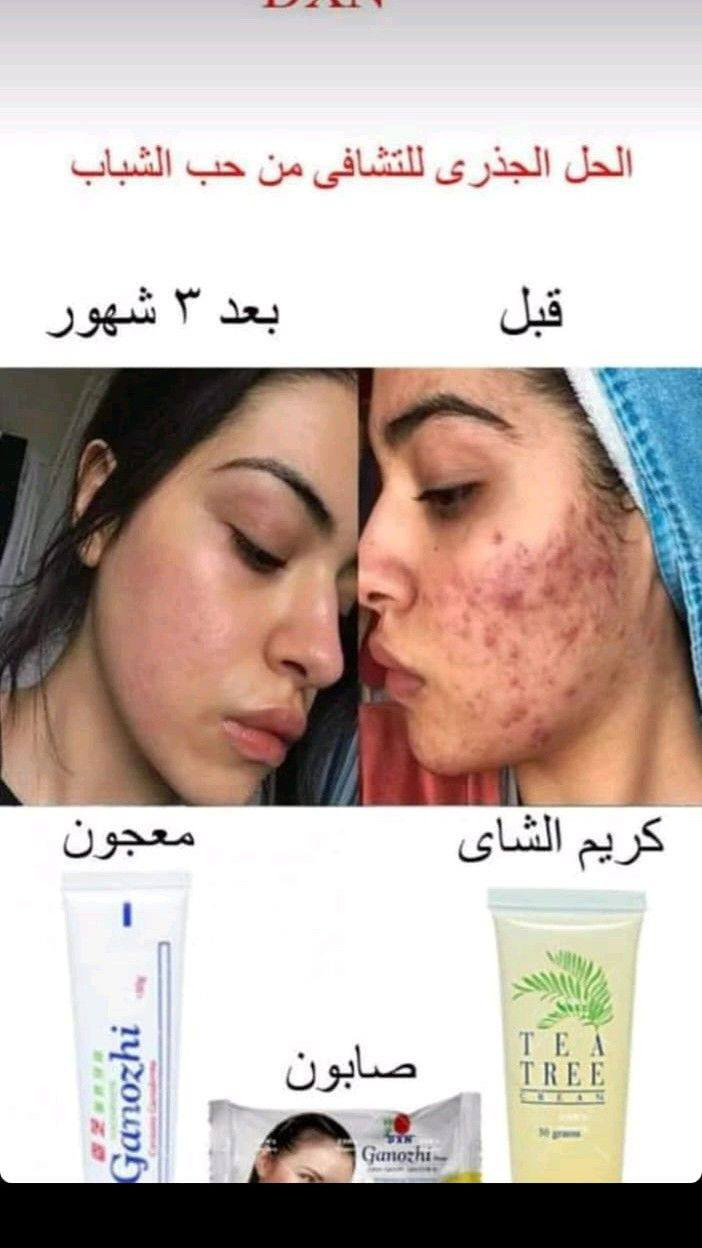 السلام عليكم ورحمة الله وبركاتة هاي المنتجات فعاله جدا اني مستخدمه يمكنكم مراسلتي خاص و ؏واتساب او اتصال ؏رقم ‏‪***********‬‏
