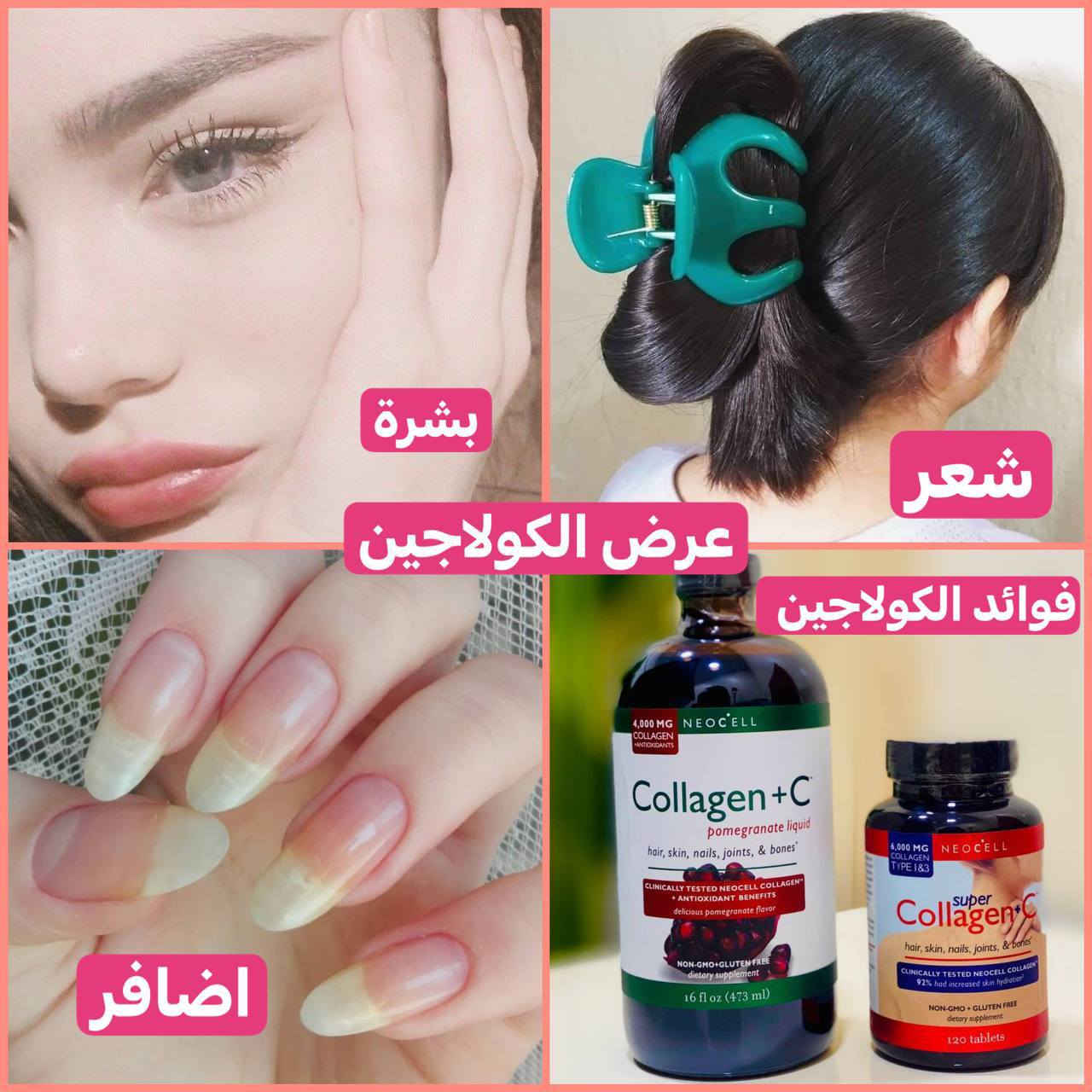 🎀عرض خاص🎀 عرض الكولاجين الامريكي🇺🇸💯 
للبشرة والجسم والشعر والاضافر والعضام والغضاريف ويقلل تجاعيد وينطي نضارة يتكون من شراب الكولاجين + حبوب الكولاجين 

1♦️حبوب سوبر كولاجين  
نوع 1 و 3 + فيتامين سي 🔥من NEOCELL الامريكيه 🇺🇸🇺🇸 تعويض نقص الكولاجين الناتج عن التقدم بالسن في البشره والشعر والبشرة والأظافر والمفاصل والعظام
♦️ زيادة ترطيب الجلد 92% عبر الدراسات الاكلينيكيه 
غير معدل وراثيا + خالية من الغلوتين
♦️مكمل غذائي
♦️التمتع بالمفاصل الصحية
♦️يعطي اشعاع ونضارة الجلد
♦️ضمان عظام صحية
♦️تقويه وتغذيه العظام والشعر 
♦️ الفيتامين سي يرفع مناعه الجسم 

2♦️كولاجين شراب الرمان مع فيتامين C
من افضل المنتجات في تقليل تساقط الشعر واعطاء نضارة للبشرة وتقوية الأظافر وهو من اكثر المكملا مبيعاً في امريكا والعالم♦️
♦️فوائد مشروب الكولاجين :
يشد البشرة ويعطيها نضارة ومظهر شبابي مبهر • 
مقوي للمفاصل والعظام
يعطي الجلد والشفتين مظهر الامتلاء ويقلل من عمق الثنايا والتجاعيد 
يقلل من خطوط وتشققات الأقدام والهالات السوداء حول العينين
منشأ العرض امريكي 🇺🇸💯


**إذا كنت صاحب هذا الإعلان وتريد حذفه لأي سبب، رجاءا أرسل رسالة إلى الدعم الفني**