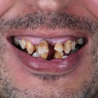 في مركز ماسة الحسينية التخصصي لطب وجراحة الفم والأسنان  دلل نفسك بابتس...
