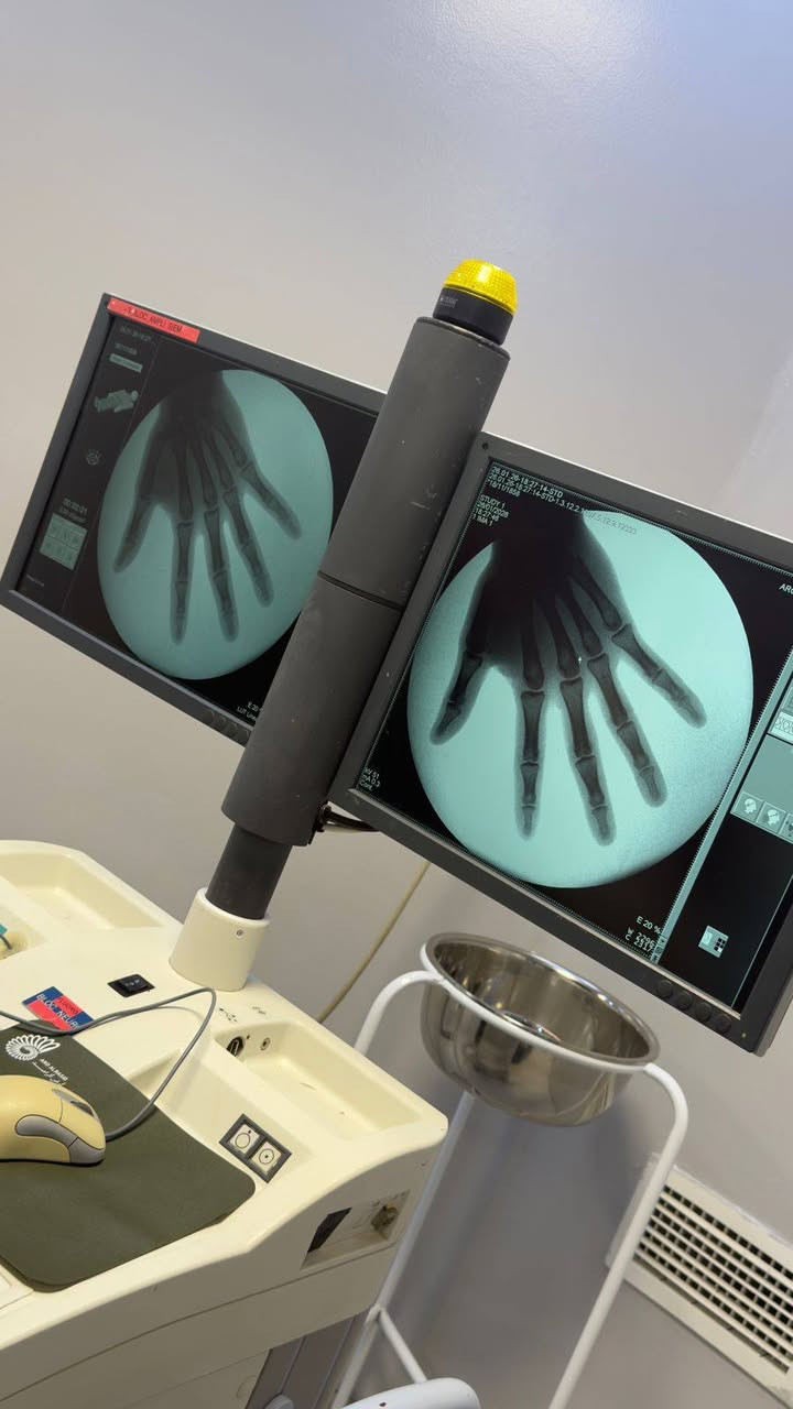 يسرّنا التعاون مع مركز الهفهاف الطبي الخيري في محافظة البصرة

حيث تم بحمد الله تنصيب وتشغيل جهاز
C-ARM Siemens Variac Arcadis
في المركز أعلاه بصورة كاملة وجاهزة للعمل.

نتقدّم بخالص الشكر والتقدير إلى إدارة مركز الهفهاف الطبي الخيري على ثقتهم بكادرنا،
آملين أن يشكّل هذا الجهاز إضافة نوعية ومهمة ضمن المشروع الخيري للمركز،
وأن يسهم في تقديم أفضل مستويات الرعاية الصحية لأهالي البصرة الكرام.

عين الراصد للأجهزة الطبية
📍 بغداد – حي الجامعة
📍 بغداد – ساحة بيروت
📍اضافة لمكاتنبنا في محافظة البصرة، واسط، القادسية، المثنى
📞 ***********
