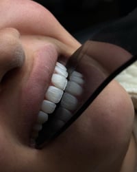 تجميل اسنان • مركز سما • الزعفرانية