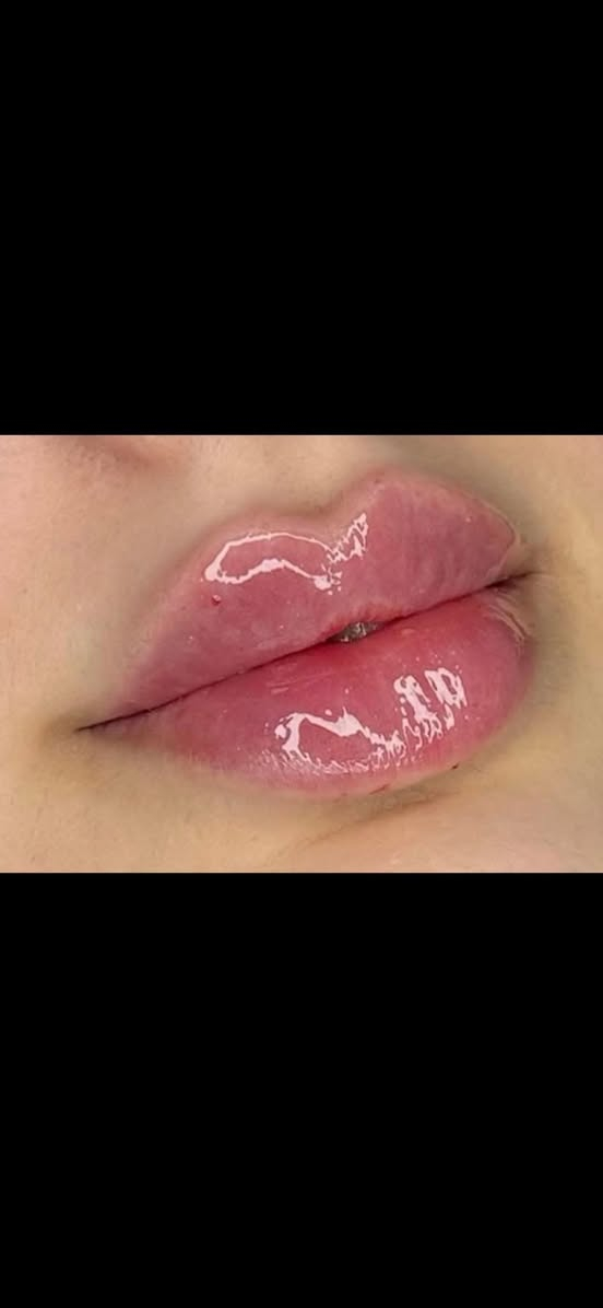 (((.    تتواجد اليوم  )))
✨ الدكتورة حنين الصراف ✨ عودة ميمونة من  السفر وصلت الكوت. 

طب التجميل غير الجراحي | نحت الملامح | شد البشرة

🔥 مو كل تجميل… يصنع فرق.
الفرق الحقيقي هو لما يطلع وجهج أجمل… والكل يلاحظ التغيير بدون ما يعرف شنو السبب.

إذا تبحثين عن:
💎 فيلر طبيعي يبرز جمال ملامحج.
💎 بوتوكس يمنحج مظهراً أكثر راحة ونضارة.
💎 تحديد الفك والذقن والخطوط الجانبية.
💎 شد الوجه والرقبة بطرق غير جراحية.
💎 علاج الابتسامة اللثوية (Gummy Smile).
💎 تجديد البشرة واستعادة إشراقتها.

فأنتِ مع المكان المناسب.

مع الدكتورة حنين الصراف نؤمن أن التجميل الحقيقي لا يغيّر ملامحك… بل يُظهر أجمل نسخة منكِ.

✔️ تقييم دقيق لكل حالة قبل أي إجراء.
✔️ استخدام مواد أصلية من مناشئ عالمية معروفة.
✔️ اختيار التقنية المناسبة حسب طبيعة الوجه واحتياجات كل مراجعة.
✔️ اهتمام بأدق التفاصيل للوصول إلى نتائج متوازنة وطبيعية.

🌸 لأن الثقة تبدأ من أول نظرة في المرآة…

📅 المواعيد محدودة، والحجز حسب أسبقية التواصل.

📲 للحجز والاستفسار:

📸 Instagram:
https://www.instagram.com/dr_haneen_alsaraf/

📘 Facebook:
https://www.facebook.com/Haneenclinic1

📍 الكوت – شارع الهورة – مجمع الطبيب الجراح – الطابق الثاني

☎️ ***********
☎️ ***********
☎️ ***********

الدكتورة حنين الصراف
خبرة… دقة… ونتائج طبيعية تعزز ثقتك بنفسك.

