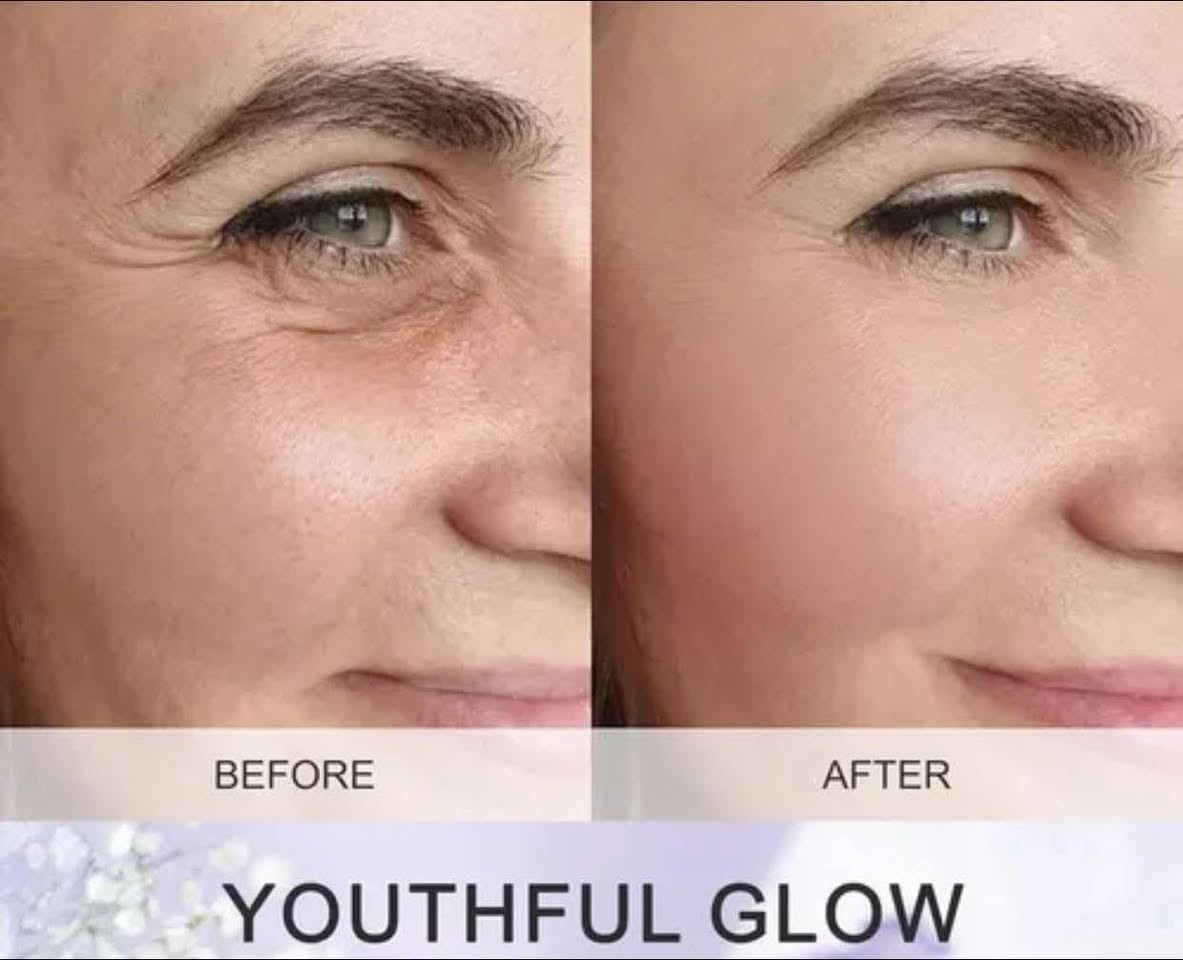 حتى وجههج يضوي ب١٤ يوم لازم تستخدمين
Melting Oil  سيروم
 (Blue Copper Peptide) Aglaiwish مع أمبولات 

 
يذيب الخطوط الدقيقه والتجاعيد 🫢
شلون!! لأن يحتوي على( DNA (Sodium DNAالمستخلص من مصادر بحرية، ويعمل على تجديد الخلايا،وإصلاح مرونة البشرة
مستخلص الجينسينغ (PANAX GINSENG)
الببتيدات (Peptides)تعتبر بديل البوتوكس الموضعي
النياسيناميد (Niacinamide / 烟酰胺)و السكوالان (Squalane / 角鲨烷):مرممات للبشرة 
زيت الورد الدمشقي (ROSA DAMASCENA) يخلي البشرة تنور

الحجز خاااص 
يتوفر توصيل لجميع المحافظات 
                      وداخل المدحتية


**إذا كنت صاحب هذا الإعلان وتريد حذفه لأي سبب، رجاءا أرسل رسالة إلى الدعم الفني**