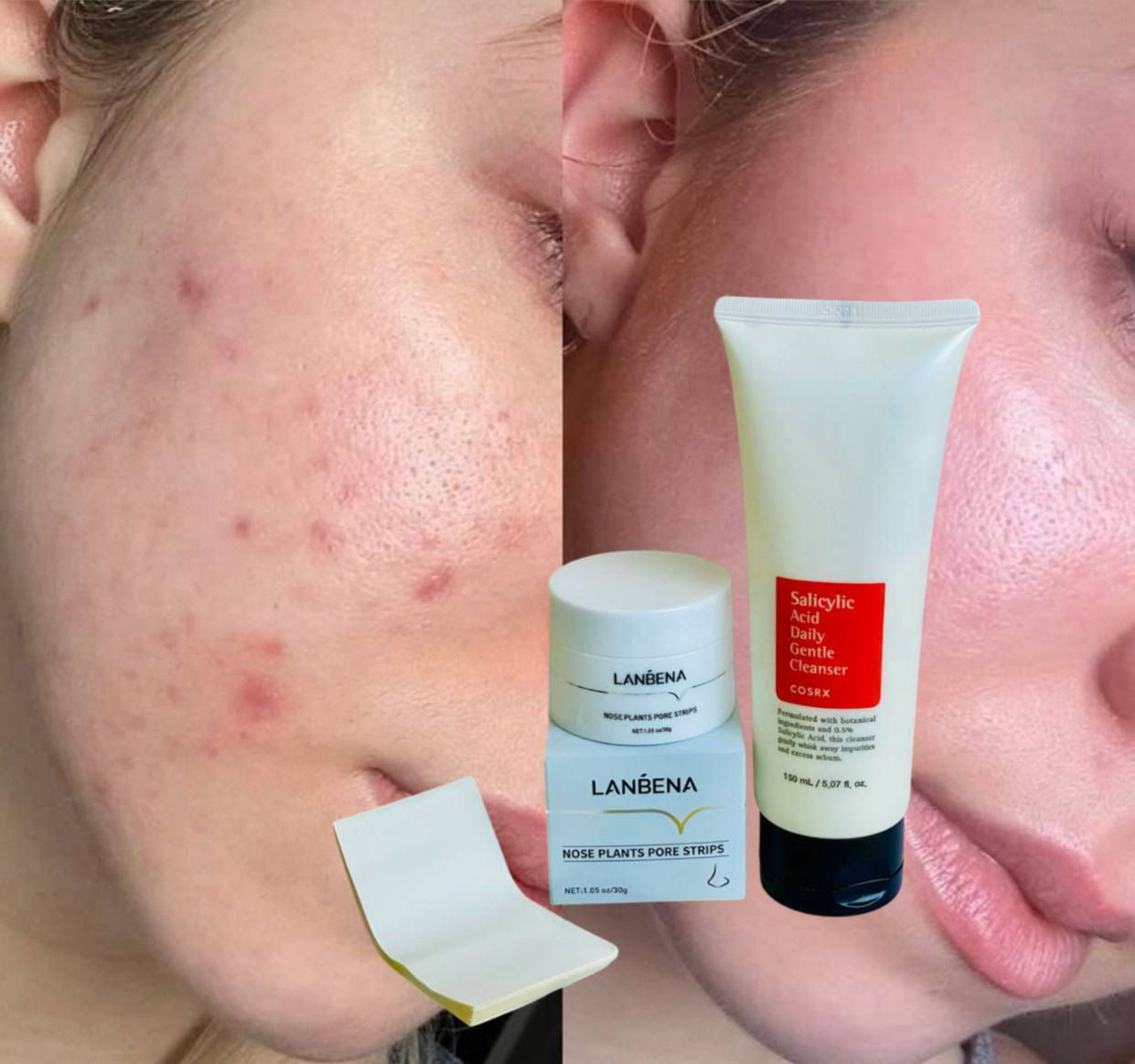 وداعاً للمسام والشوائب.. أهلاً بالبشرة الصافية! ✨
​سر البشرة "الفلتر" صار بين إيديج! جمعنا لج قوة لانبينا مع ذكاء كوزركس في عرض واحد يقضي على كل مشاكل البشرة المزعجة:
​تنظيف عميق للمسام والتخلص نهائياً من الرؤوس السوداء.
​بشرة ناعمة كالحرير وخالية من الدهون والحبوب.
​إشراقة فورية تلاحظيها من أول استخدام.
​لا تقبلين بأقل من بشرة مثالية ونظيفة يومياً! 🔥
​#بشرة_زجاجية #عناية_بالوجه #نضارة_البشرة
​للحجز والاستفسار تفضلو


**إذا كنت صاحب هذا الإعلان وتريد حذفه لأي سبب، رجاءا أرسل رسالة إلى الدعم الفني**