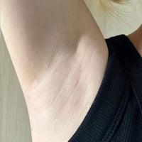 جل سنو وايت • تفتيح البشرة • إزالة البقع