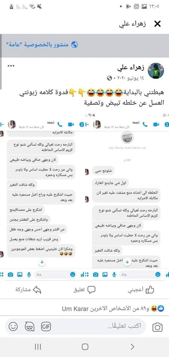 جزء بسيط من تجارب تركيبه الكولاجين
تصفية تبيض نظاره لمعه بدون اي آثار جانبية
جايكم العيد من هسة بلشو استخدموها😍😍


**إذا كنت صاحب هذا الإعلان وتريد حذفه لأي سبب، رجاءا أرسل رسالة إلى الدعم الفني**