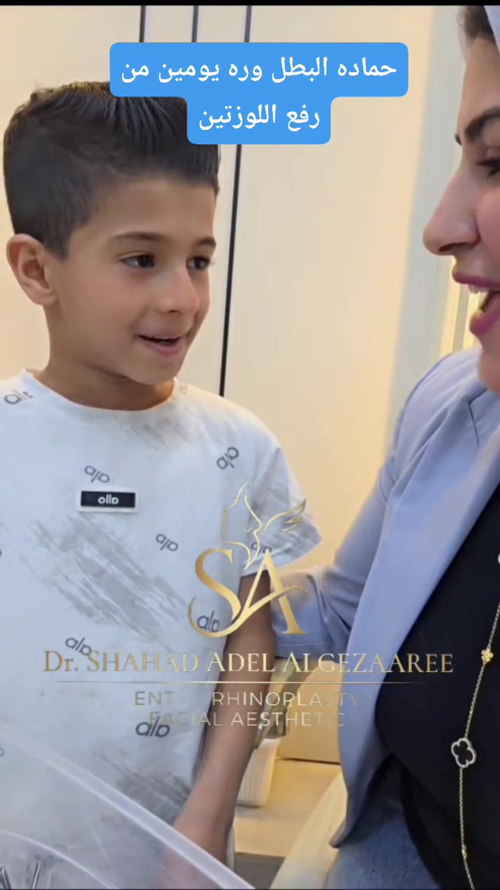 شكد يحتاج الطفل وره عملية اللوزتين حتى يصير زين؟؟
حماده اجه اليوم مسوي شعره سبايكي ومتحمس للتصوير 😂♥️

الدكتوره شهد عادل الجزائري
جراح اختصاص انف اذن حنجره وتجميل الانف والوجه (جراحي _لاجراحي)
(بورد عربي_بورد عراقي)

الدوره
شارع ابو طياره
مجاور فايكنك بركر وأسواق خالد وليد
للحجز
***********
***********
كل ايام الاسبوع من ساعه ٥ الى ساعه ٩

الثلاثاء والخميس فقط حجز مسبق

الجمعه عطلة العياده
 #انف_اذن_حنجره #رفع_اللوزتين #شخير #تنفس_صحي #اكسبلور
