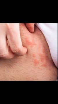 دكتوره أسيل • جلدية وتجميل وليزر • كشف مجاني الاثنين