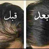 زيت شعر عشبي • تكثيف بسبوع • توصيل مجاني