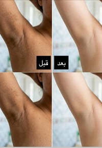 تفتيح سريع • إبط ومناطق حساسة • طبيعي ١٠٠٪