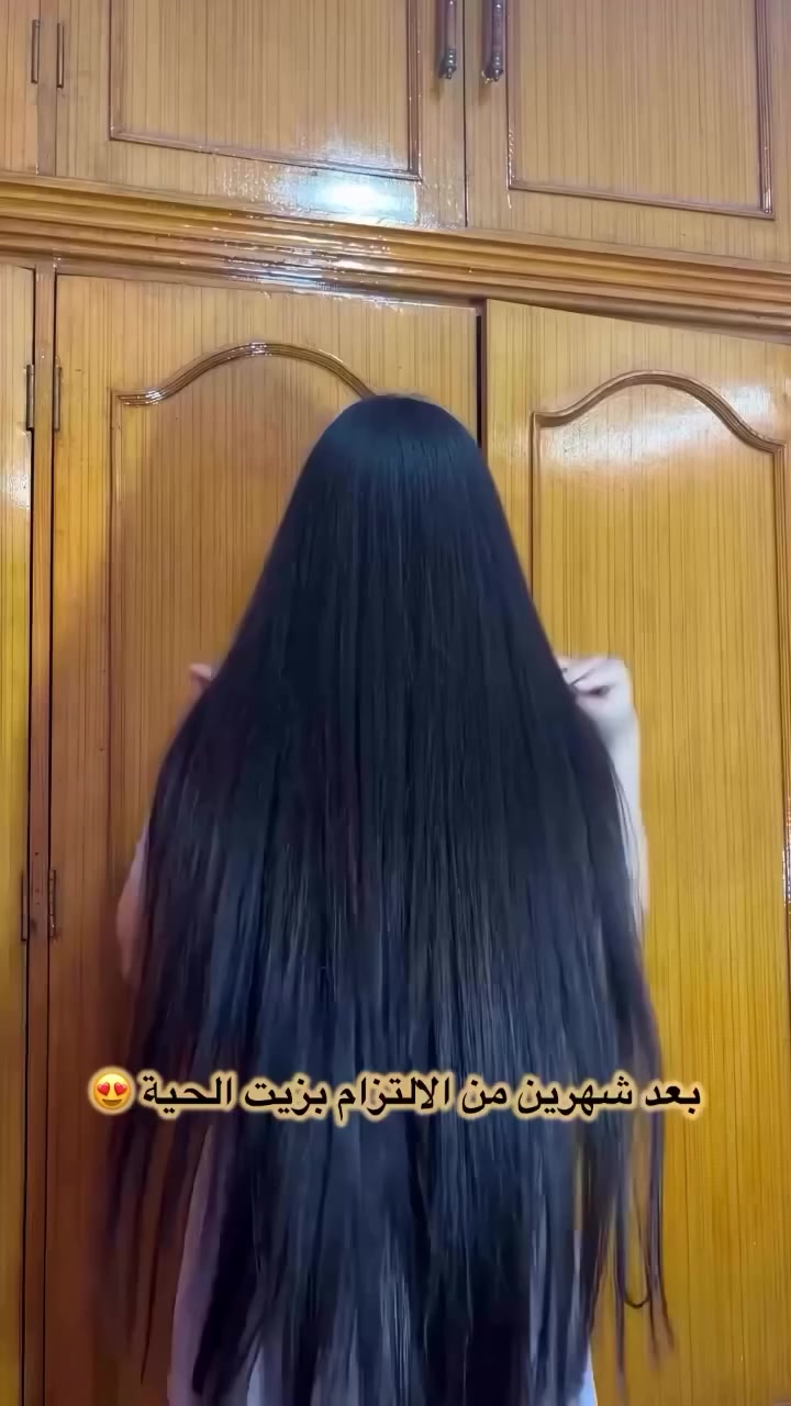 زيت الشعر بتركيبة خاصة من د. ليان بيوتي
سر الطول… والكثافة… واللمعة الطبيعية 🤍
خليط زيوت مختارة بعناية لدعم:
🔸 تقليل التساقط
🔸 تغذية فروة الرأس
🔸 تحفيز نمو شعر صحي
🔸 تقوية الشعرة من الجذور للأطراف
يُستخدم 2–3 مرات بالأسبوع
مع مساج خفيف لمدة 5–10 دقائق وتركه ساعة على الأقل ✨
من أول أسابيع تحسين بالفرق…
وشعرج يصير أنعم وأقوى وأكثف 🌸
د. ليان بيوتي
لأن شعرج تاجج 👑🤍


**إذا كنت صاحب هذا الإعلان وتريد حذفه لأي سبب، رجاءا أرسل رسالة إلى الدعم الفني**