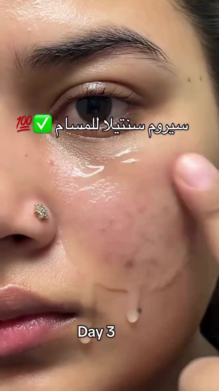 ✨ سيروم سنتيلا لبشرة هادئة ومشرقة! 🌿💧
هدوء، نضارة، ترطيب يومي 💚
تفتيح ووترطيب ونضاره عن تجربه بنات

#سنتيلا #بشرة #نضارة #هدوء #عناية


**إذا كنت صاحب هذا الإعلان وتريد حذفه لأي سبب، رجاءا أرسل رسالة إلى الدعم الفني**