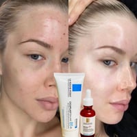 لاروش بوزيه • سيكابلاست B5 • سيروم ريتينول