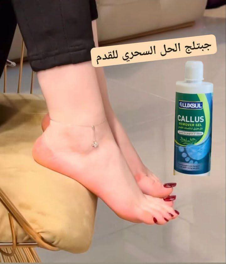 كالوس قدم الاصلي 💯💯 للحجز دايريك او واتساب  ***********

 توفر منتج ( كالوس ) للقدم تگدرين تشتغليه بالبيت
 وبكل سهوله 
وضيفته يشيل الجلد الخشن الي بالكعب خلال دقائق
الاستخدام : نقع القدمين بالماء الدافئ والصابون لمدة (5) دقائق وبعدها يتم تجفيف القدمين بالمنشفه 
وبعدها تخلين سائل كالوس بواسطة قطنه على كعب القدم المتضررره لمده لاتتجاوز ( 3) دقائق وبعدها تشيلين الجلد الميت بالمحكاكه ثم تشطف القدم بالماء

وتمتعي بأقدام ناعمه وكلها أنوثه☺️

#توصيل_جميع_المحافظات البصرة, العراق
