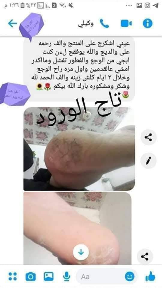 يعاني  معظم النساء والرجال   من تشققات القدم خلال فصل الصيف بسبب حرارة الطقس التي تسبب جفاف الجلد، ومن ثم تظهر التشققات
🌸😍😘فوائد هذا المنتج لدينا🍅💐

يزيل الجلد الميت 💐
📌 ينعيم القدمين.😍
📌 يرطيب الكعبين ومنع تشقّقهما.😘
📌 إعطاءأسفل القدمين اللون الوردي.☺
يقضي ع الخشونه 🤗😍

ويستعمل يوميا على القدم مره واحده  حيث تدهن القدم ويتم ارتداء الحفايه الطبيه بعدها وسنلاحظ الفرق %
 
السعر15 كامل مع التوصيل والحفايه وعلبه
15الف الاقضيه ام كامل مع التوصيل والحفايه وعلبتين
لايوجد محل فقط توصيل داخل الناصريه 
الحجز ع الخاص مغ الست هدى الحجامي


**إذا كنت صاحب هذا الإعلان وتريد حذفه لأي سبب، رجاءا أرسل رسالة إلى الدعم الفني**