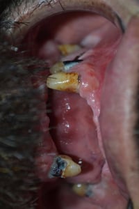 مسابقة • تقويم اسنان • حي 17