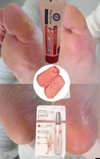 كريم إزالة الجلد • جواريب سيليكون طبية • توصيل محافظات