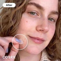COSRX • لصقات حب الشباب • جبله