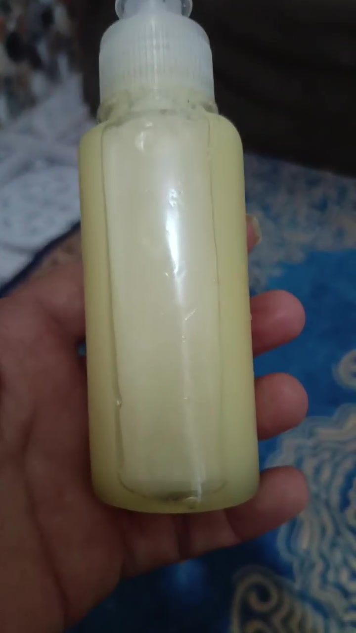 واسعار مناسبه مناسبه زيوت طبيعيه 100%


**إذا كنت صاحب هذا الإعلان وتريد حذفه لأي سبب، رجاءا أرسل رسالة إلى الدعم الفني**