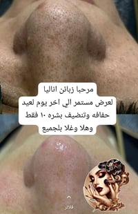 جددي بشرج من لدهون ولرؤس لسوداء دللي بشرتج ويا اناليا بيوتي حي لنصر قر...