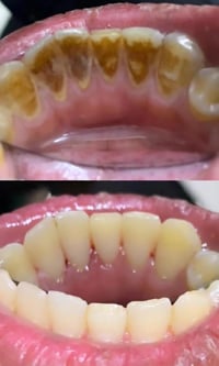 مجانا • علاج اسنان • كربلاء الحولي