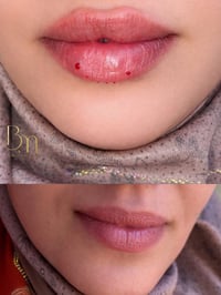 عيادة التجميل الاولى في الحسينية وتحت إشراف أطباء مختصين استغلوا آخر ا...