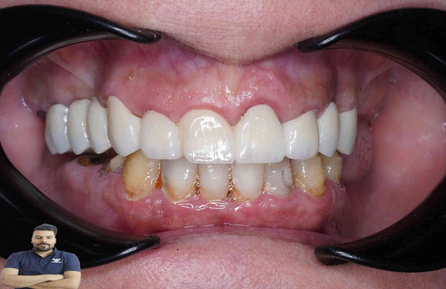 المراجعة مسوية تركيب بغير عيادة وماعاجبهة الشغل اجتي عادتة يمنة وكانت هاية النتيجة

العنوان / المسيب / شارع البلدية / مقابل دكتور جعفر وفي للاطفال/مجاور عالم الحليب

للحجز والاستفسار
***********
***********
