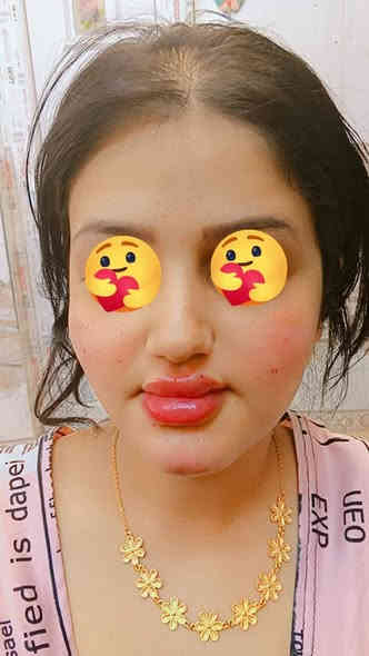 عروض ولاول مرة اسعار ولا في الخيال تحطيم الاسعار🤛
نبدي بعروض الاكرلك 💅
فول دزاين ب20الف فقط 😍
دزاين ب15
سترونك ب10
تبسات ب10
جلش فثط ب5
تنظيف قدم ب5فقط
قص شعر ب5فقط
حفافة وشمع ب5فقط
ميش شعر قصير 15
ميش من الكتف للخصر ب25
 فلر سعر السيسي الواحد👄 فلر اودري ب25
فلر كوري اراستي ب50
فلر كوري آبتك ب75
التغير الشامل بالفلر الكوري 250
بوتكس عين القط ب100
بوتكس جبين كامل ب100
بوتكس وجه كامل ب250
بلازما انبات وتقوية بصيلات  الشعر ب75
بلازما مفعلة ب35
جميع انواع التاتو ب25
الوشومات تبدي من ال10وفوك
بغداد /دورة/ابو دشير /الشارع العام بالقرب من مكتبة حيدر الضامد سنتر ريفان بيوتي
***********
#هاشتاك @إشارة #بغدادبصرةاربيل #كربلاءديوانية
