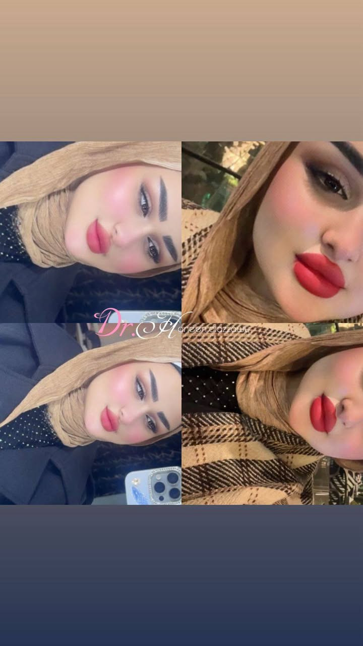 ♥️عيد الحب♥️ ويانه غير (لكل جميلات بغداد) هالعيد دللي نفسج بهدية جمال مميزة🎁
عروض الحقن والفلر الخاصة بعيد الحب
العرض لمدة محدودة ،لا تفوتي الفرصه
العنوان :عيادات خبراء الطب التخصصي /مقابل كراج الاسدي.               ***********📞
#تجميل ـ بغداد#فلر#حقن ـ تجميلية - #جمال - طبيعي#عيد الحب  # عروض #ستايل- عراقي
 للاستفسار و الحجز⏪Haneen Alazzawy
