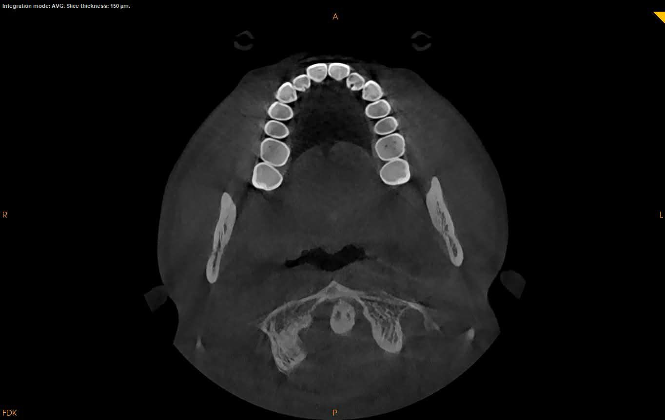 كيرستريم cbct
Fov 10*10
Fov 10*16
للطلب والاستفسار ***********
