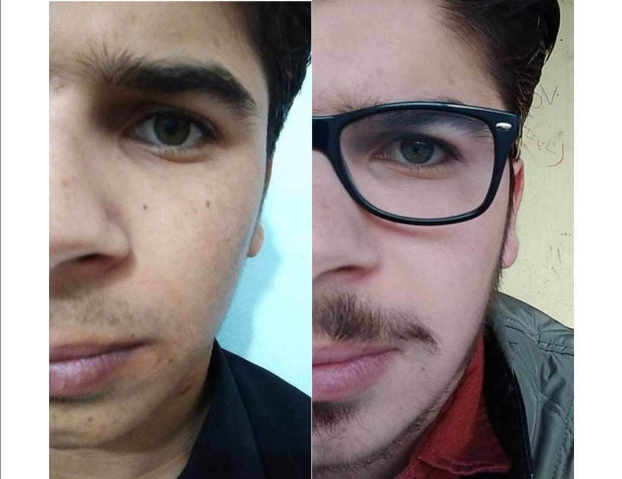 تۆش بەدەست کێشەکانی پێستەوە دەناڵێنی نازانی چی لێبکەیت و بەچی چارەسەری بکەیت🤔
کرێمێکت دەوێت بەگرەنتی👌 پارەگەڕانەوە ئەگەر سوودی نەبوو لەماوەی تەنها 🔺١٥ڕۆژدا
🟡سێتی کرێمی ئەمەریکی ئەڵلماس کەخاوەنی کوالێتی کۆنترۆڵە ☑️
ئەوەی ئەم کرێمەی بەکارهێناوە بۆهەمیشەیی ماڵئاوای لەتەواوی کێشەکانی ڕوخساری کردوە و دەوروبەری داوای ئەم کرێمەیان لێکردوە بەهۆی سوودو گۆڕانکاریە زۆرەکەیەوە 👍
ئەم کرێمە چارەسەری تەواوی ئەم کێشانەی ڕوخسارت بۆدەکات بەگرەنتیەوە 
🔺لابردنی زیپکەو شوێنەواری زیپکە
🔺لابردنیی پەڵەی سەرپێست و ژێرپێست
🔺لابردنی ڕەشی ژێرچاوو یەک ڕەنگ کردنی روخسار بەتەواوی
🔺لابردنی سوتاوی بەرخۆرو نەرم کردن و سافکردنی دەماوجاوو بەگشتی یەک ڕەنگردنی 
🟡کارتی گرەنتی و زەمانی بەکارهێنانی لەگەڵدایە سوودی تەواوت وەرنەگرت قەرەبوی تەواو دەکرێیتەوە 
بۆداواکردن و زانیاری زیاتر پەیوەندی بەم ژمارەیەوەبکەن
🚕گەیاندنمان بەردەستە 
📞***********
