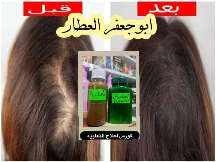 الحسينية سوق الكبير داخل العلوه مال مخضر


**إذا كنت صاحب هذا الإعلان وتريد حذفه لأي سبب، رجاءا أرسل رسالة إلى الدعم الفني**
