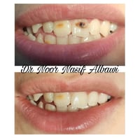 يعلن مركز الماس عن تواجد الدكتورة نور الباوي في شهر رمضان ايام ( سبت /...