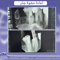 يسعدنا استقبالكم يومياً عدا يوم الجمعة  اوقات العمل  قبل الافطار من ال...