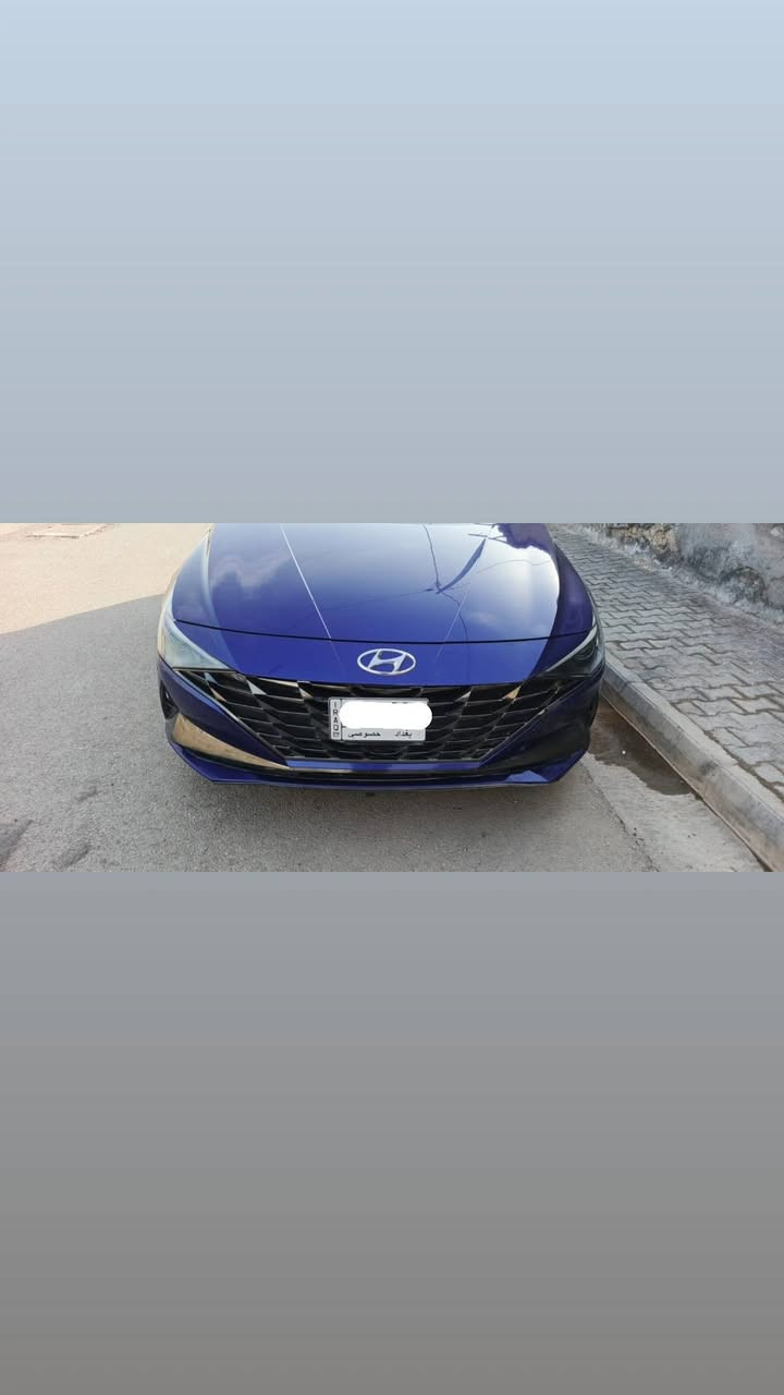 سلام عليكم النترا 22 استقطاع من الموظف بيها وكاله عامه من الموظف فول مواصفات للاخير ثلاث وضعيات قياده بصمه عدد 2 خليجي فقط الموضح بل صور لطخه الباقي مكفول ممشه ٨٠
سعر 147 رقم ***********
رقم بغداد
