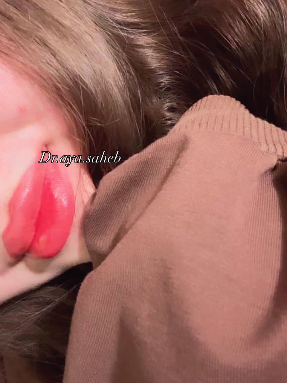 هالمرة البوست من تصوير مراجعاتي🫶🏻 رڤيو فلر الشفة لمختلف مراجعاتي حرفياً صورة احلى من صورة حرت شنو انزللكم💗💗
الديوانية 📍
للحجز/***********
