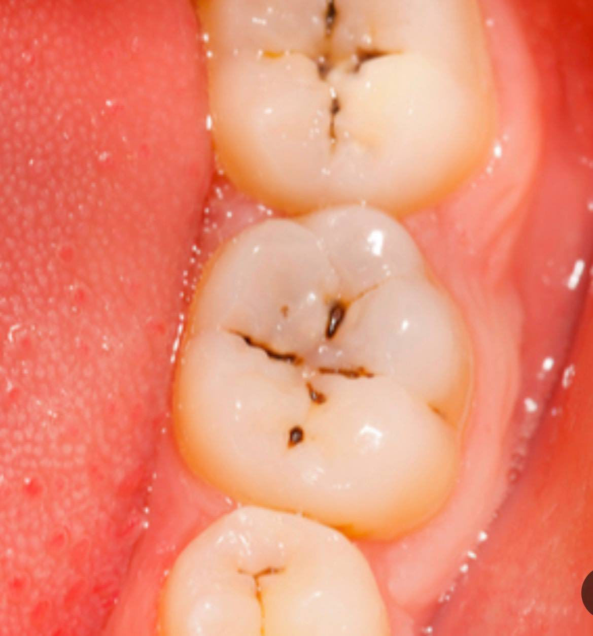 علاج الأسنان مجاناً مجاناً
حجز على واتساب ***********
عنوان موصل شلالات
