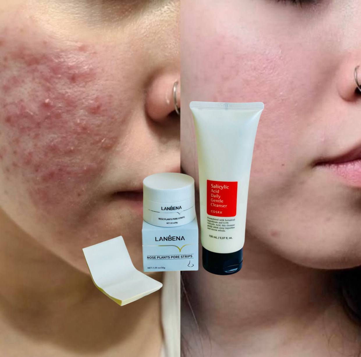 ✨ ثنائي العناية بالبشرة الكوري وصل ✨
إذا تريدين بشرة مشدودة، ناعمة ومشرقة مثل الكوريات 😍🇰🇷

💗 كريم الكولاجين الكوري
▪️ يقلل التجاعيد والخطوط الرفيعة
▪️ يرطب البشرة ترطيب عميق طول اليوم
▪️ يعطي ملمس ناعم ومرن
▪️ ينطي نضارة وحيوية من أول استخدام

🫧 غسول COSRX الأصلي
▪️ ينظف البشرة بعمق بدون ما ينشفها
▪️ يساعد يقلل الحبوب والرؤوس السوداء
▪️ ينظم إفراز الدهون
▪️ يخلي البشرة نظيفة ومنتعشة


**إذا كنت صاحب هذا الإعلان وتريد حذفه لأي سبب، رجاءا أرسل رسالة إلى الدعم الفني**