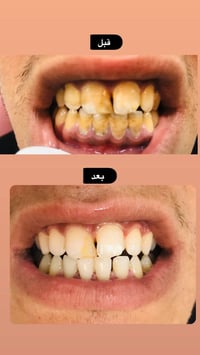 العمل مجاناً التواصل 07867680713