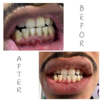 عيادة تنظيف • ساعة ١١ الصبح • كلية الرشيد حي الحسين