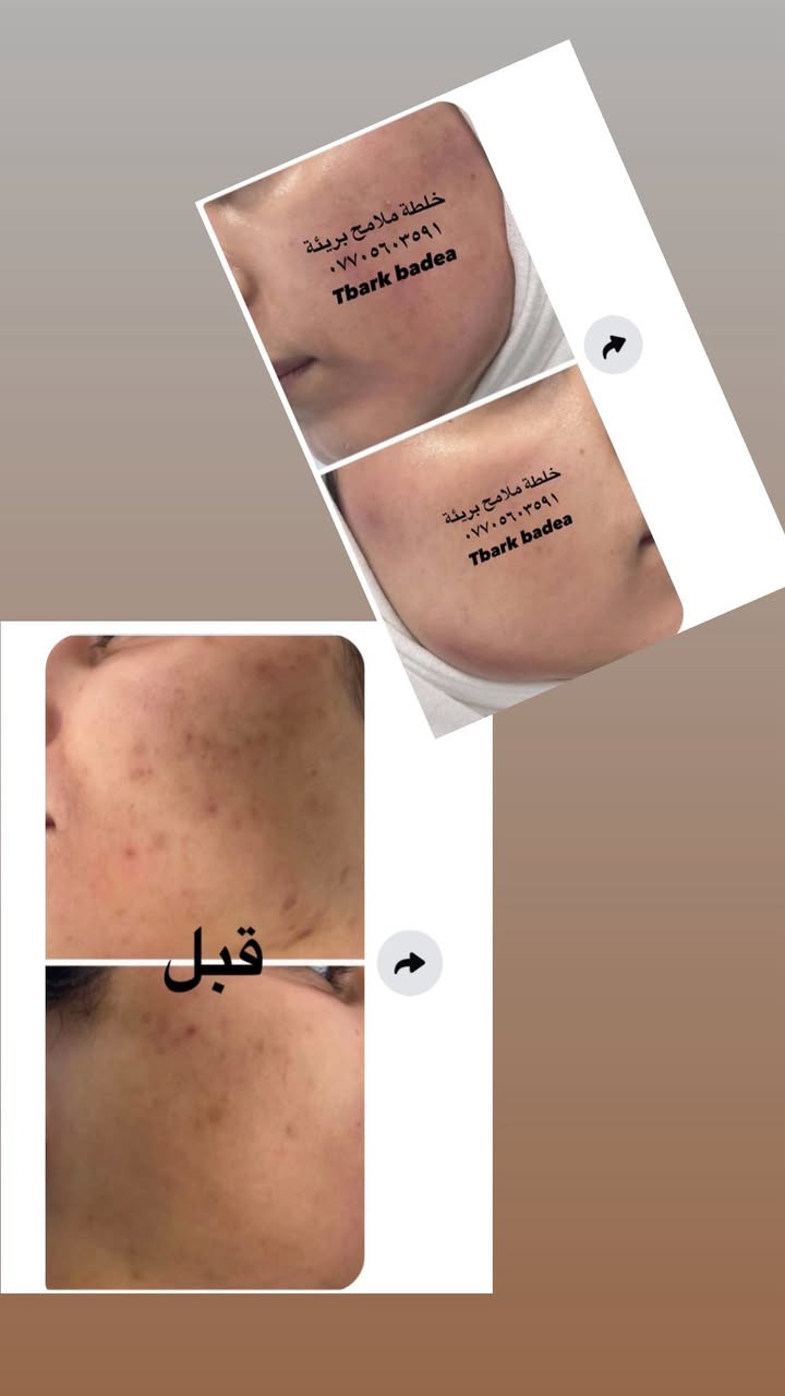 عليها القرأن الي مجربه براندي خلطة ملامح بريئة وفايدها تعلق اهنا بنات يتابعون التعليقات يردون يستخدموهاويستفسرون منكم  👈🌹


**إذا كنت صاحب هذا الإعلان وتريد حذفه لأي سبب، رجاءا أرسل رسالة إلى الدعم الفني**